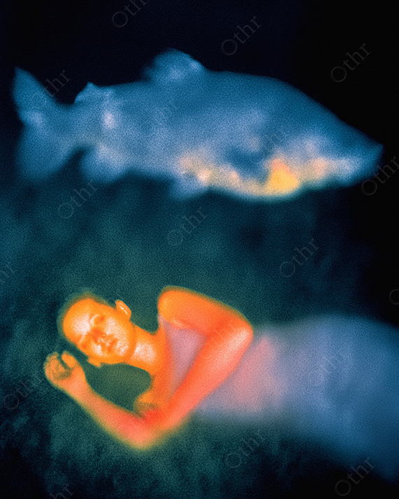 Woman dreaming of a large glowing fish